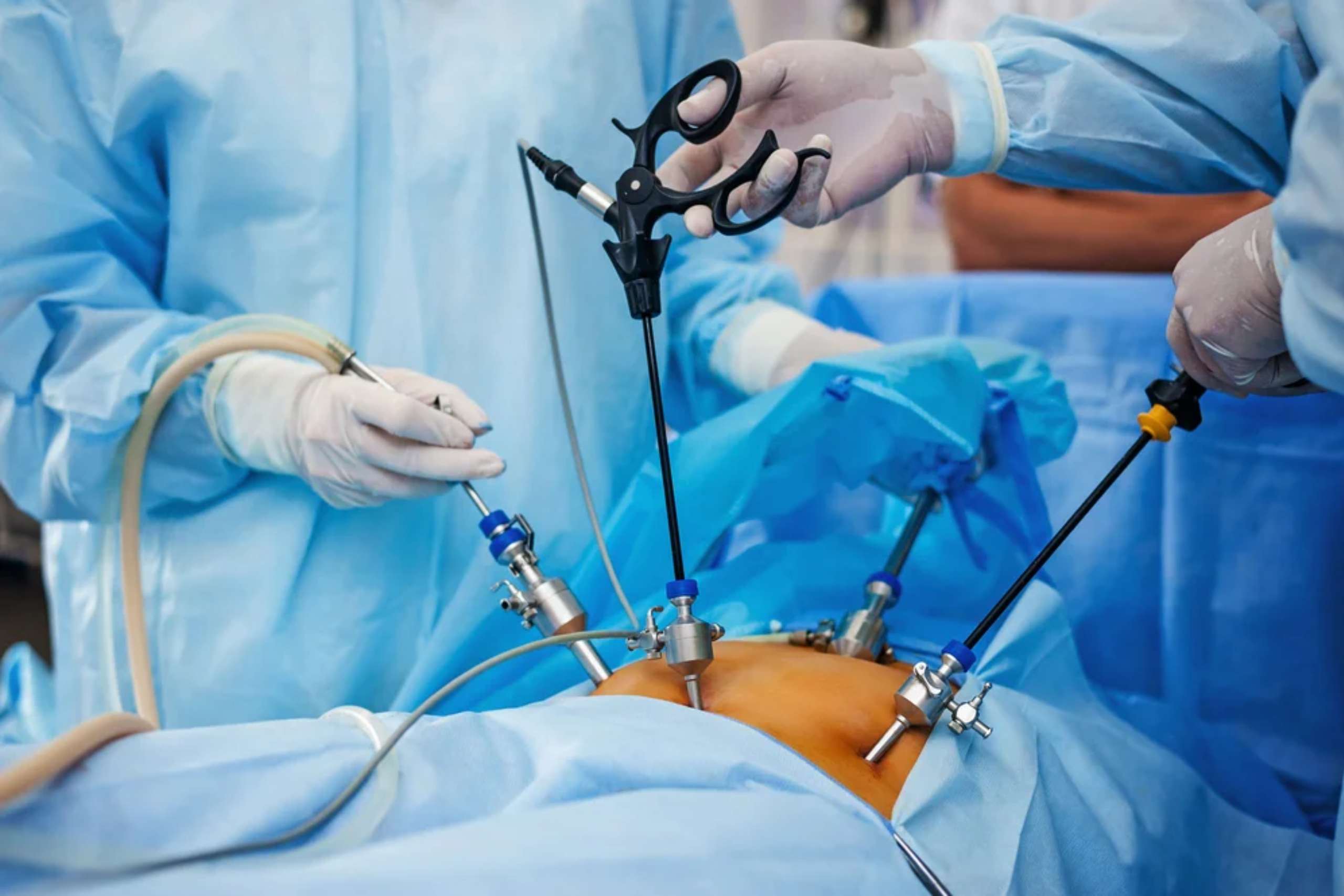 General and Laparoscopic Surgery