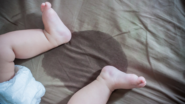 Childhood Bedwetting: What Parents Need to Know