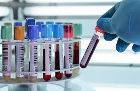 Why Regular Blood Tests Are Important for Your Health